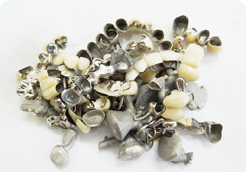 歯科金属 レアメタル 金 銀 パラジウム ⑥☆パラジウム 金パラ 銀歯 除去冠 約17g 歯科 金属 素材（銀歯